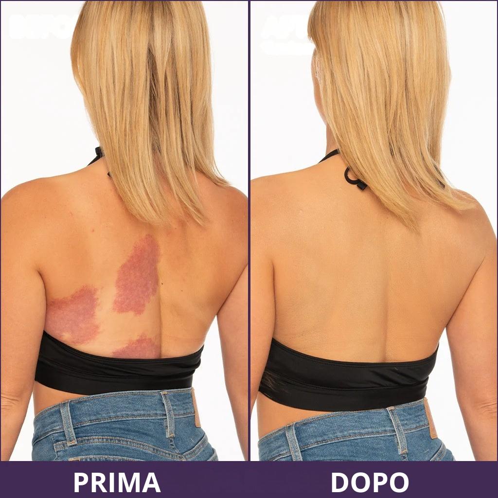 Crema coprente corpo anti-imperfezioni