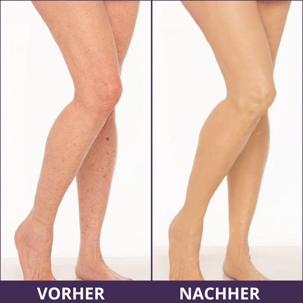 Crema corporal anti-imperfecciones