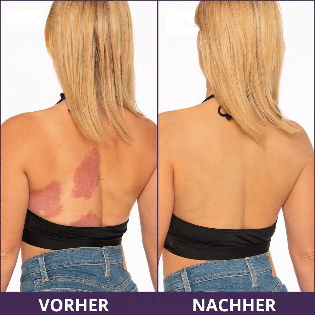 Crema corporal anti-imperfecciones