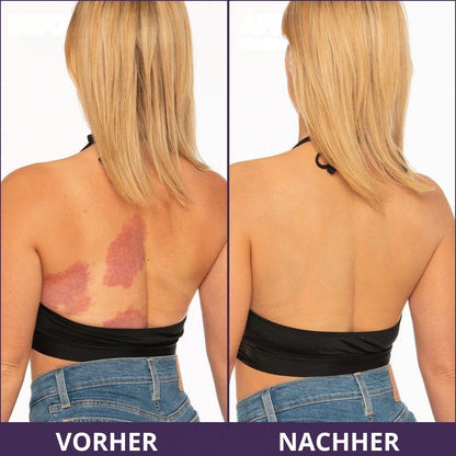 Crema corporal anti-imperfecciones